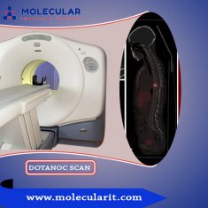 Molecularit – DOTANOC Scan procedure are highly sensitive and specific for detecting gastr ...