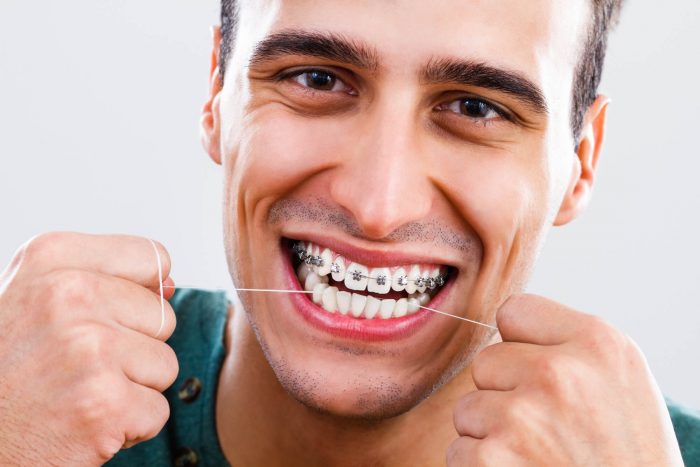 Advantages Of Adult Orthodontics Near Me